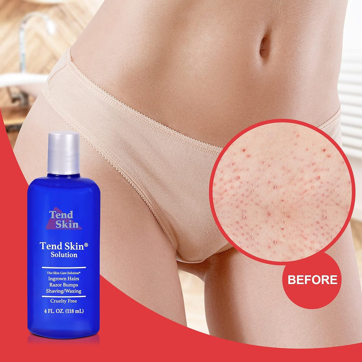 Tend Skin Ingrown Hair Solution Aftershave