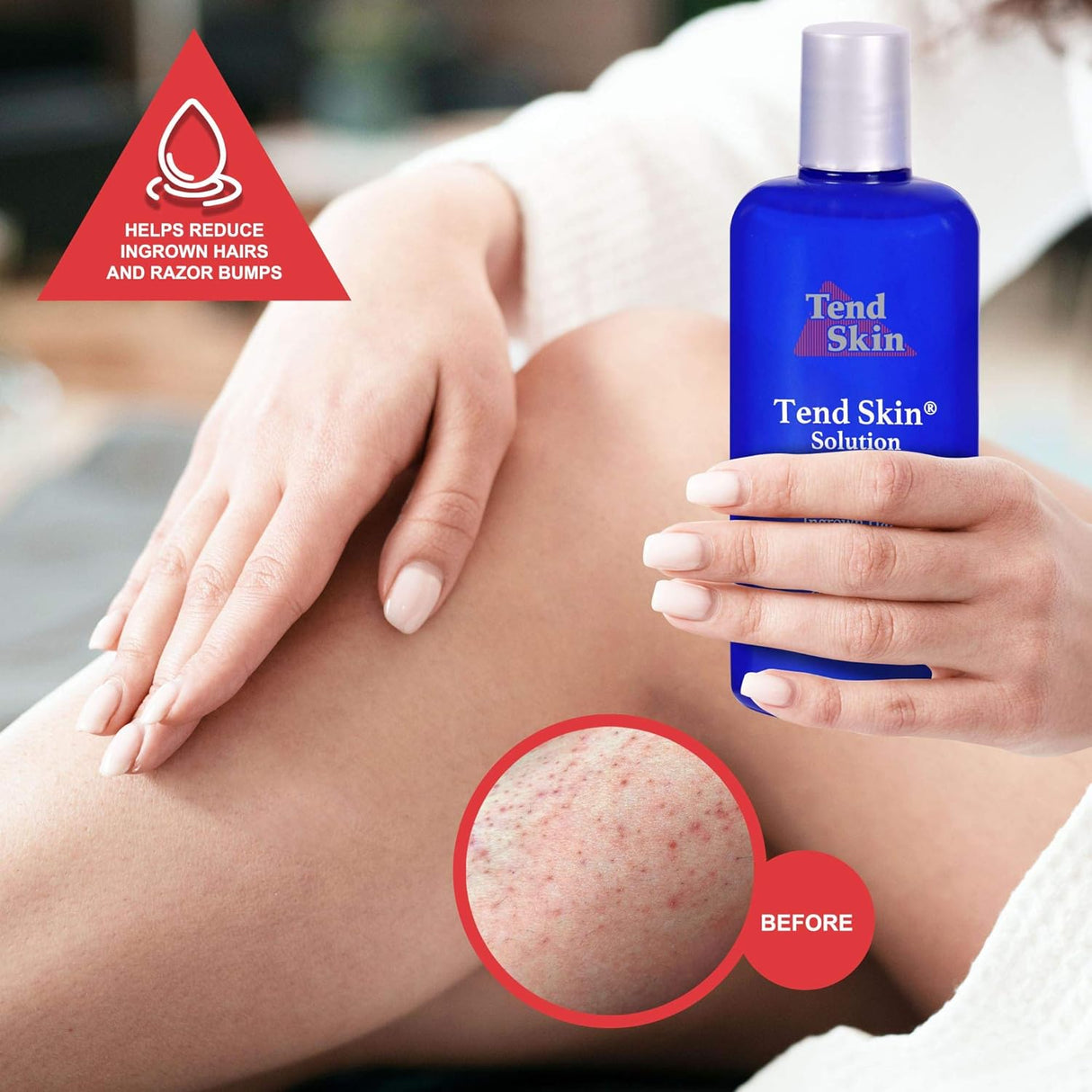 Tend Skin Ingrown Hair Solution Aftershave